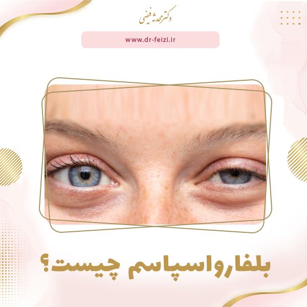 بلفارواسپاسم چیست و چرا چشم ها ناخواسته بسته می شوند؟