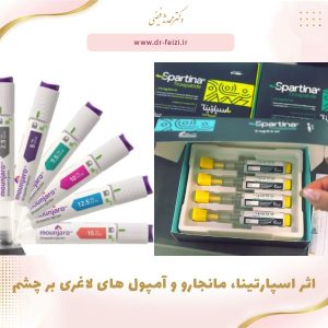 اثر اسپارتینا، مانجارو و آمپول های لاغری بر چشم