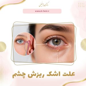 علت اشک ریزش چشم_توضیح آموزشی دکتر محدثه فیضی