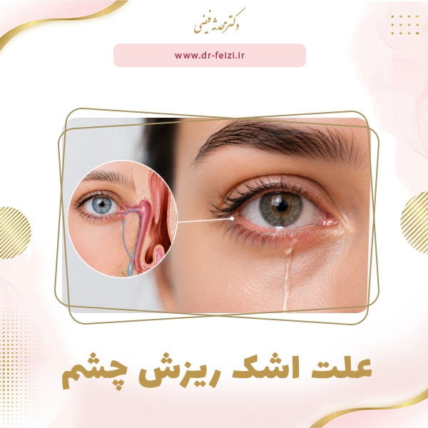 علت اشک ریزش چشم_توضیح آموزشی دکتر محدثه فیضی